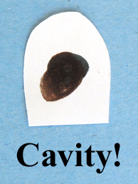cavity